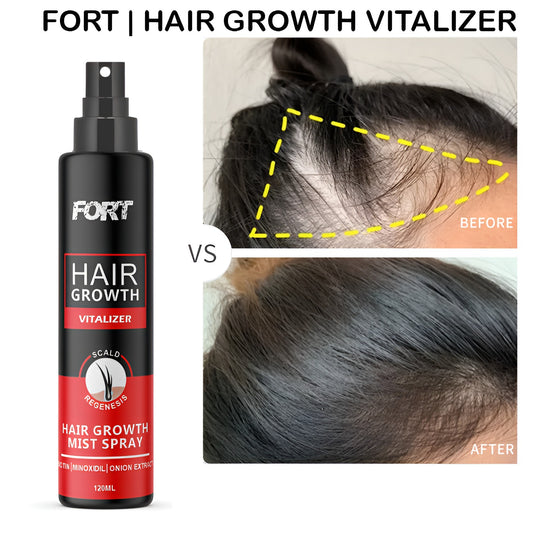 FORT Hair Growth Spray